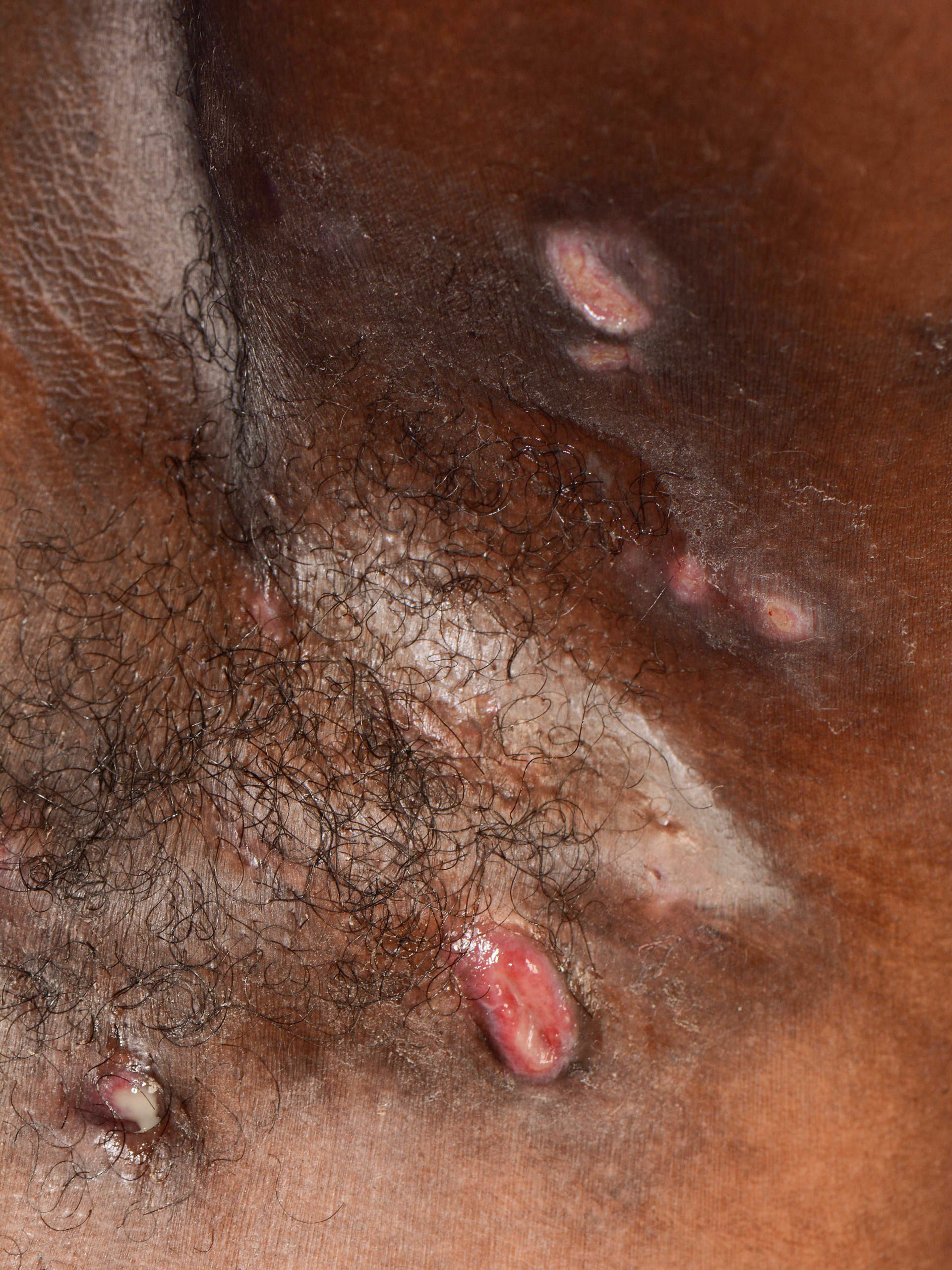 tirzepatide weird taste in mouth Fighting COVID might leave you with a bad taste in your mouth